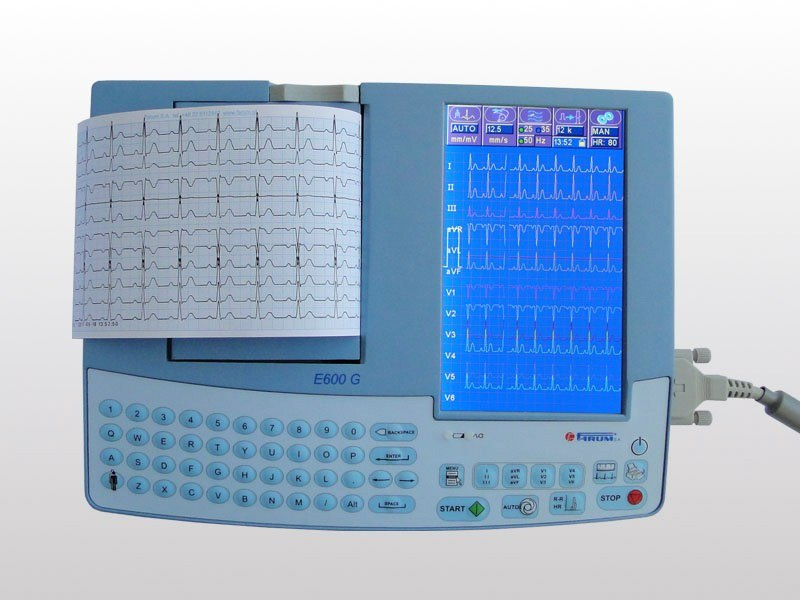 Aparat Ekg 600 G Aparat Ekg 600 G