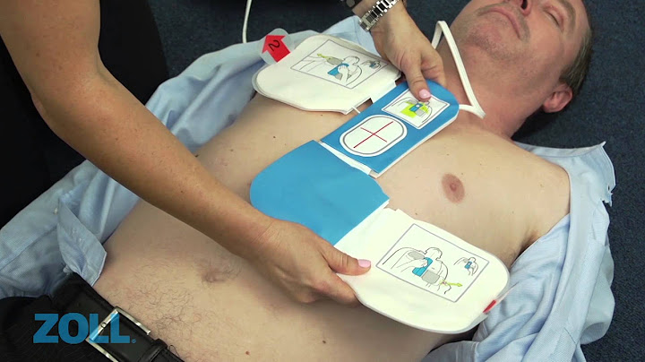 AED Plus Zoll - film instruktażowy